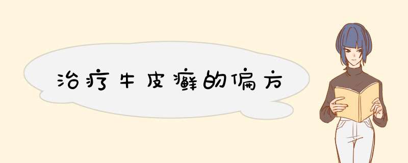 治疗牛皮癣的偏方,第1张