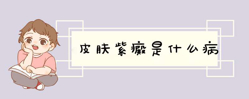 皮肤紫癜是什么病,第1张