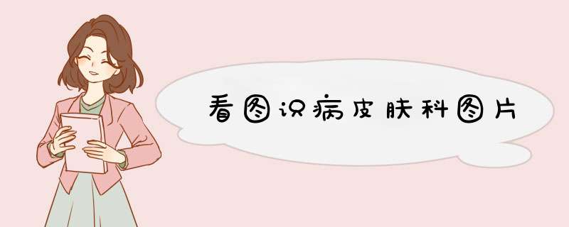 看图识病皮肤科图片