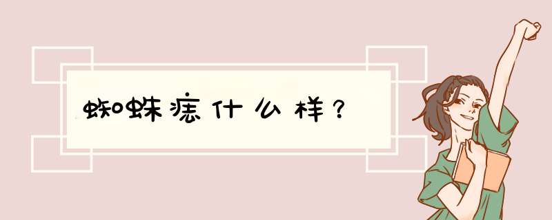蜘蛛痣什么样？,第1张