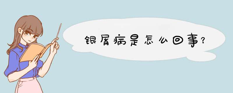 银屑病是怎么回事？,第1张