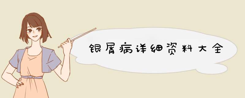 银屑病详细资料大全,第1张